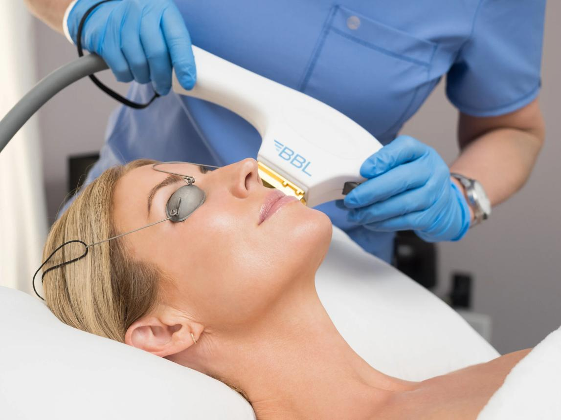 Sciton Laser Services,